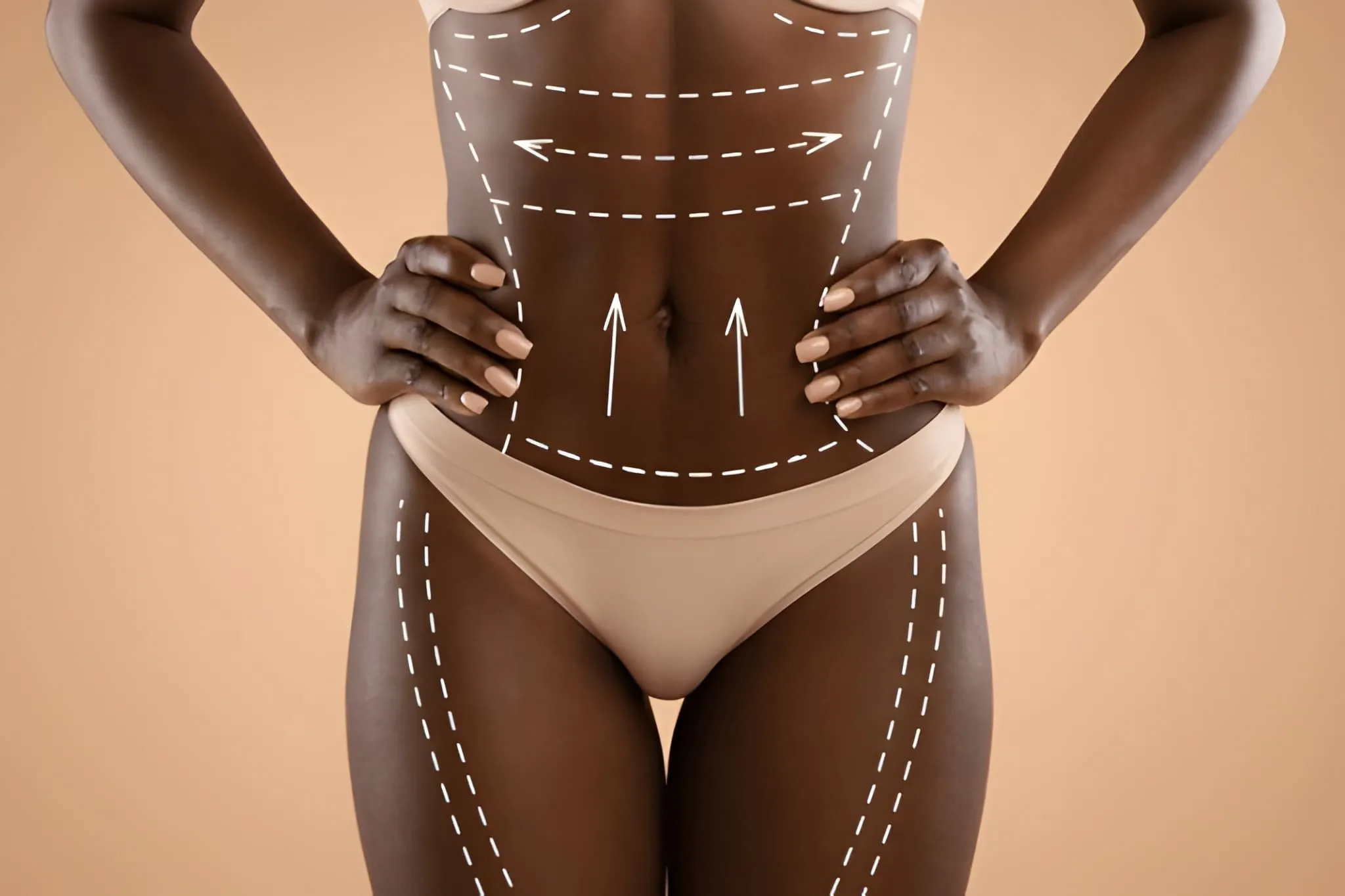 Body contour lines marked on a client's torso