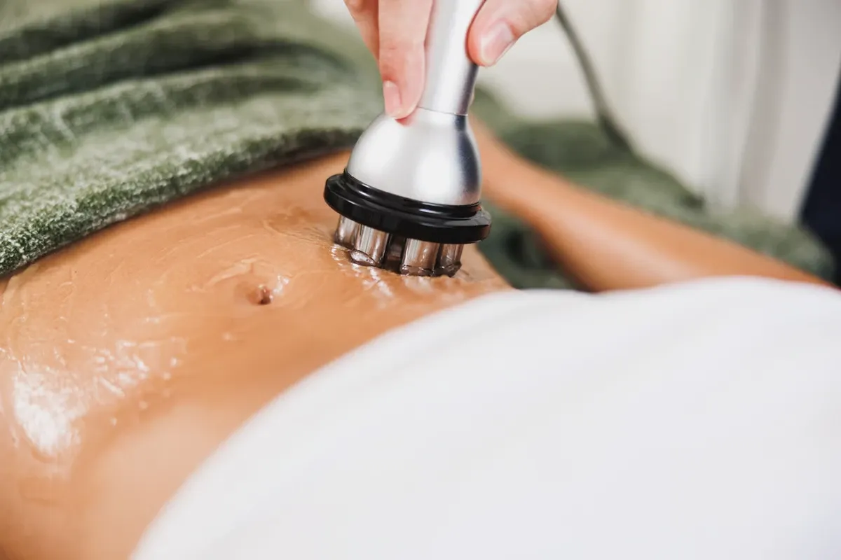 RF skin tightening on the stomach